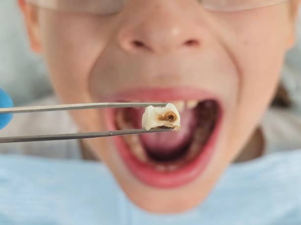 Best Walk-In Emergency Dentist in Bear Creek, FL